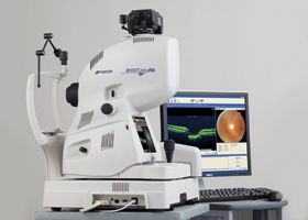 Topcon OCT- Malitz